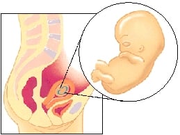 تغییرات جنین و مادر در ماه سوم بارداری-دکتر پریسا علمی- جراح و متخصص زنان، زایمان و نازایی-دوره تکمیلی لاپاراسکوپی-دوره تکمیلی سونوگرافی بارداری و زنان دوره تکمیلی لیزر هیرسوتیسم-دارای بورد تخصصی-gynaecology-متخصص زنان و زایمان