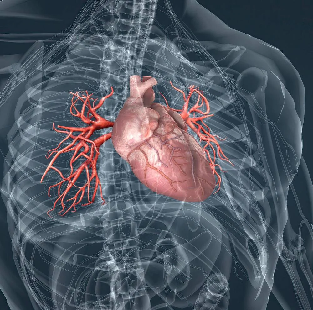 تصویری از سیتیاسکن قلبی