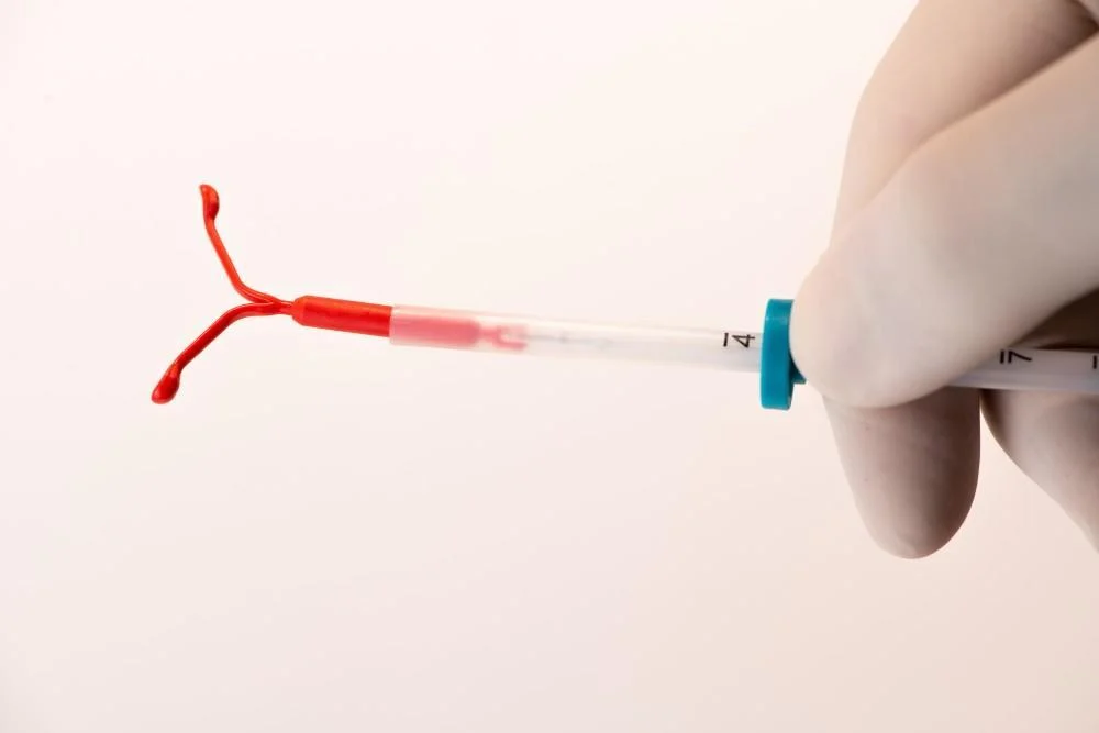 دستگاه داخل رحمی IUD و نحوه قرارگیری در رحم